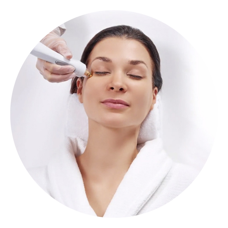 radiofrequency - RF - dry eye treatment